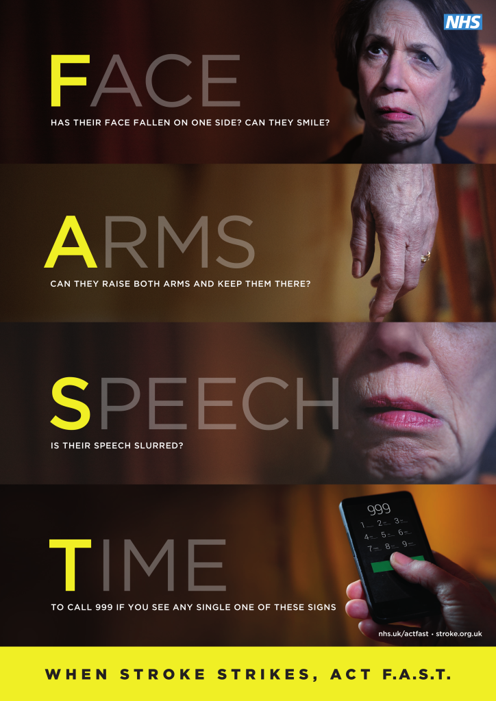 FAST stroke awareness poster explaining Face, Arms, Speech and Time symptoms and advising people to call 999 immediately.