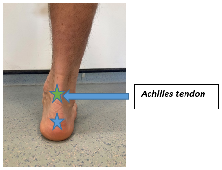 Achilles Tendon